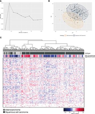 Low Transforming Growth Factor-β Pathway Activity in Cervical Adenocarcinomas